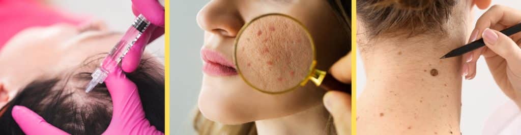 Dermatology & Skin Treatment Services Available in Delhi NCR