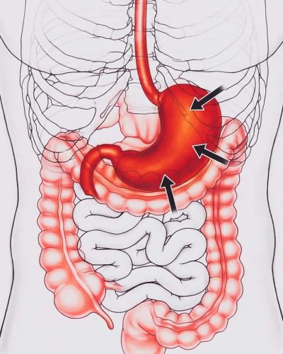 best Gastroenterology cure medicines in delhi